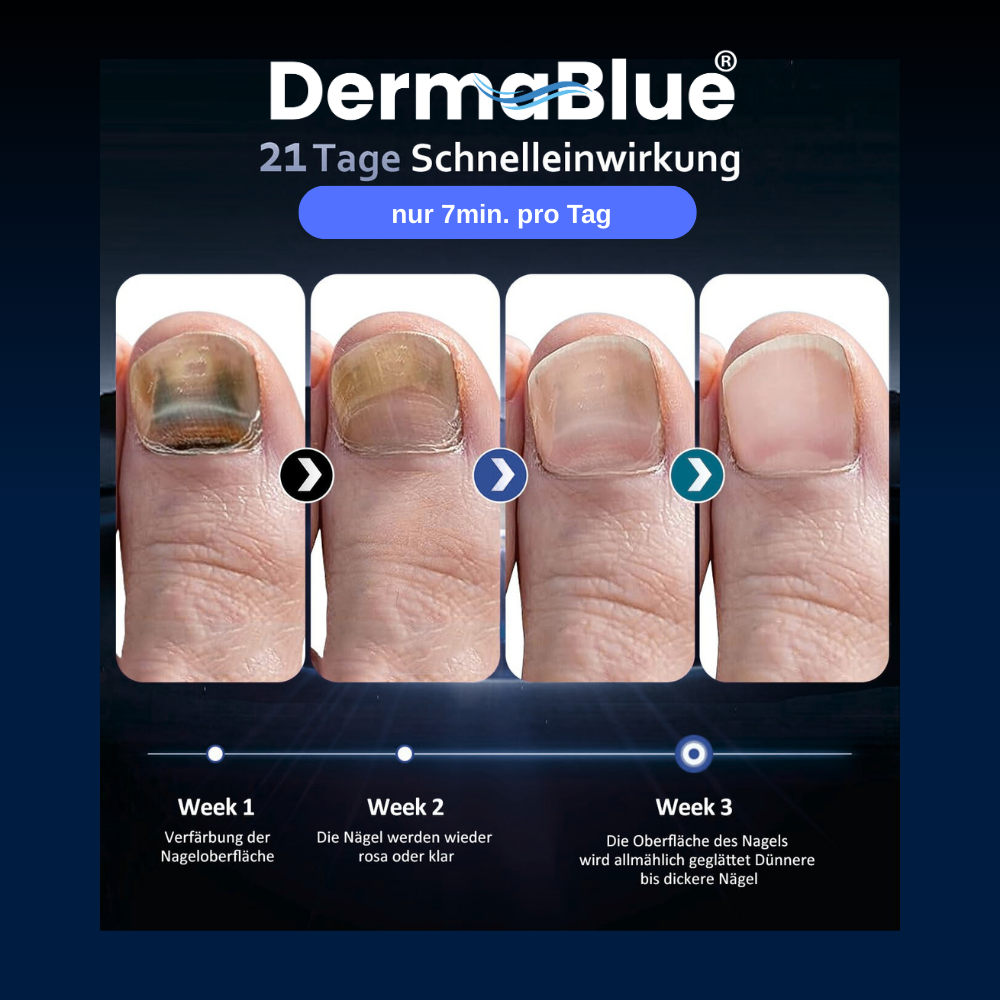 DermaBlue® UV-Blaulicht Therapiegerät gegen Nagelpilz
